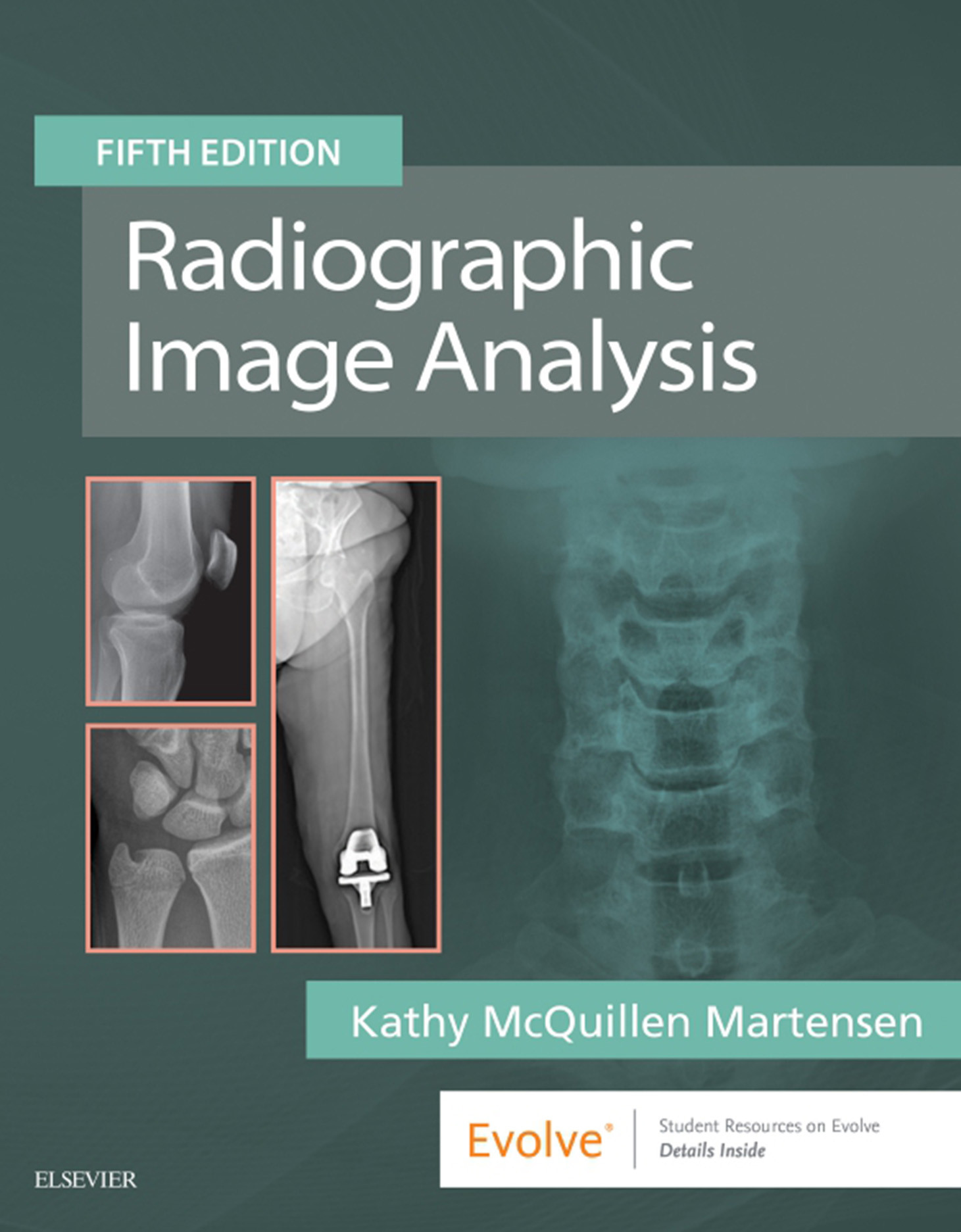 Cover Radiographic Image Analysis E-Book