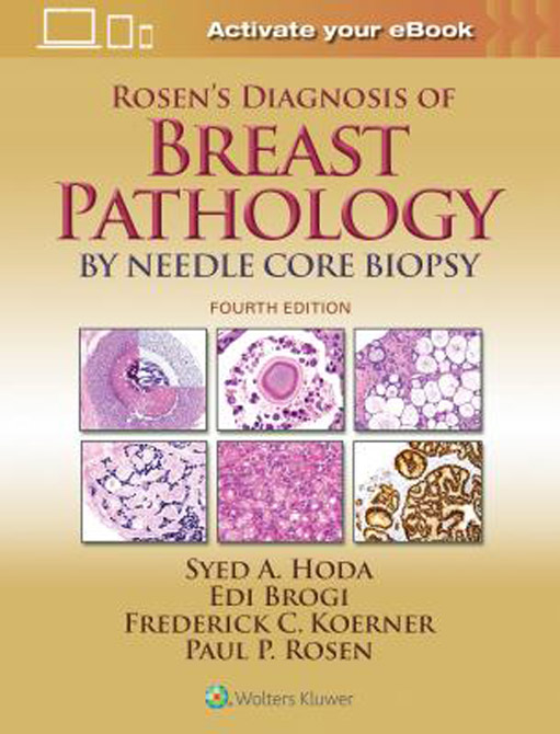 Rosens Diagnosis of Breast Pathology by Needle Core Biopsy