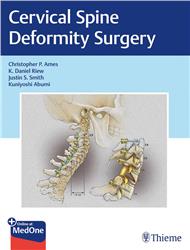 Cover Cervical Spine Deformity Surgery