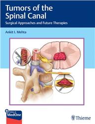 Cover Tumors of the Spinal Canal