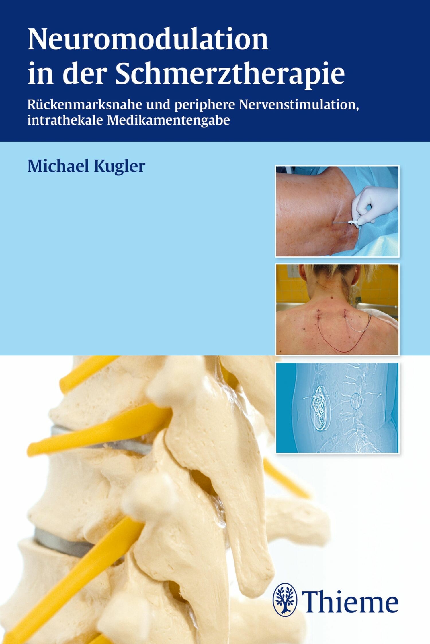 Neuromodulation in der Schmerztherapie