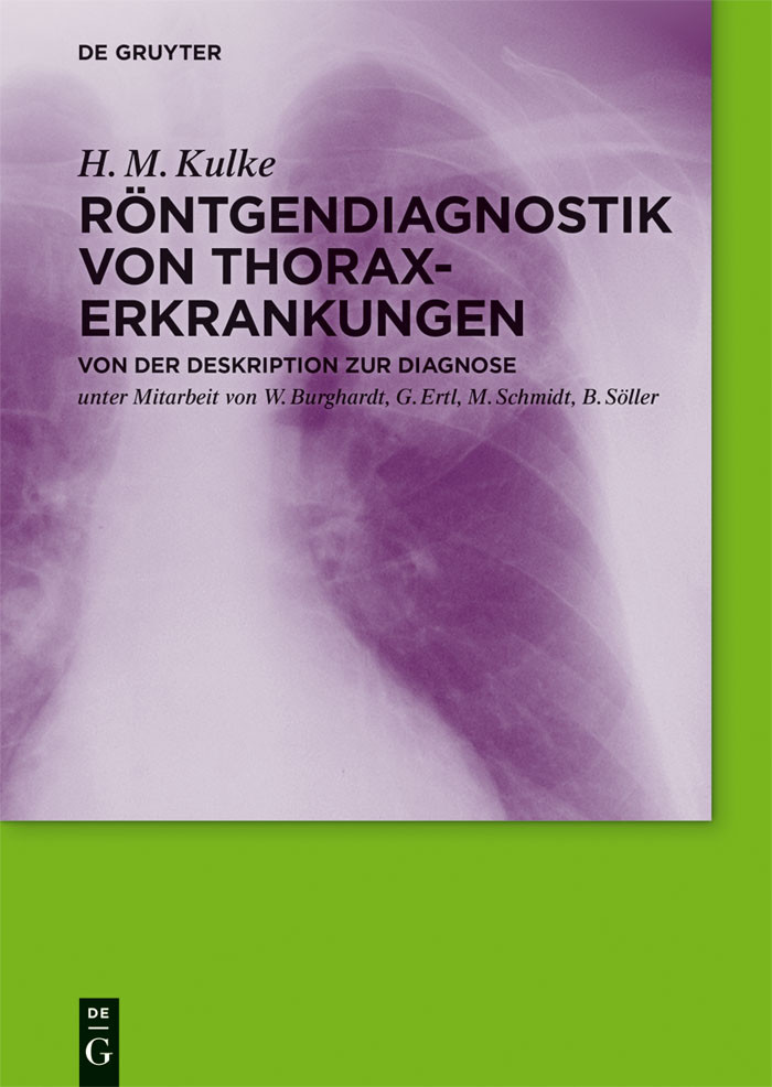 Cover Röntgendiagnostik von Thoraxerkrankungen