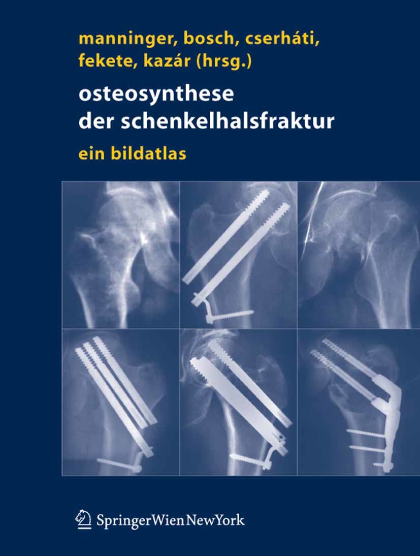 Osteosynthese der Schenkelhalsfraktur