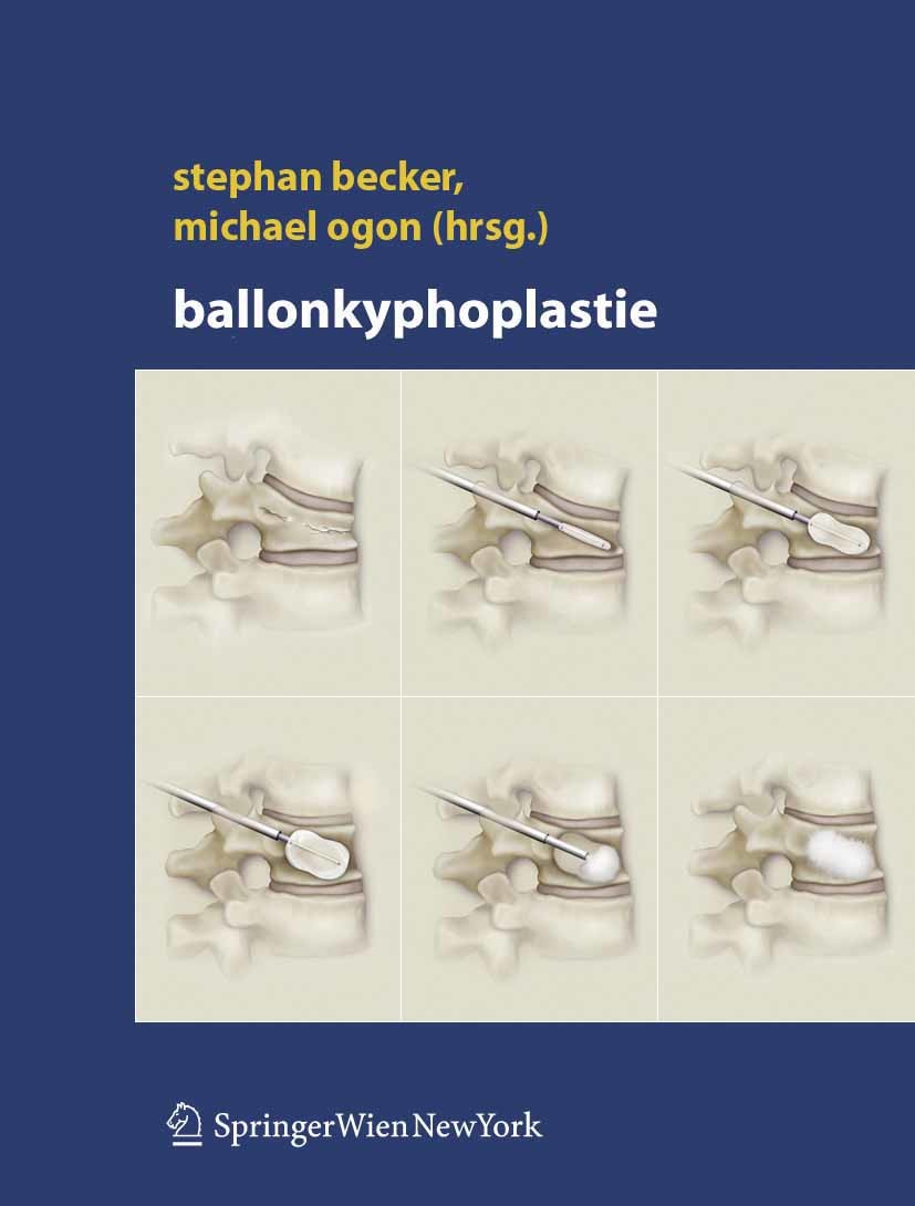 Cover Ballonkyphoplastie