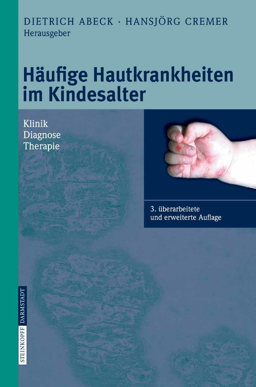 Häufige Hautkrankheiten im Kindesalter