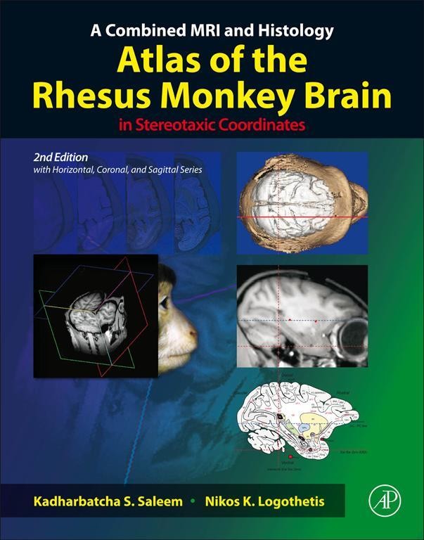 Cover A Combined MRI and Histology Atlas of the Rhesus Monkey Brain in Stereotaxic Coordinates