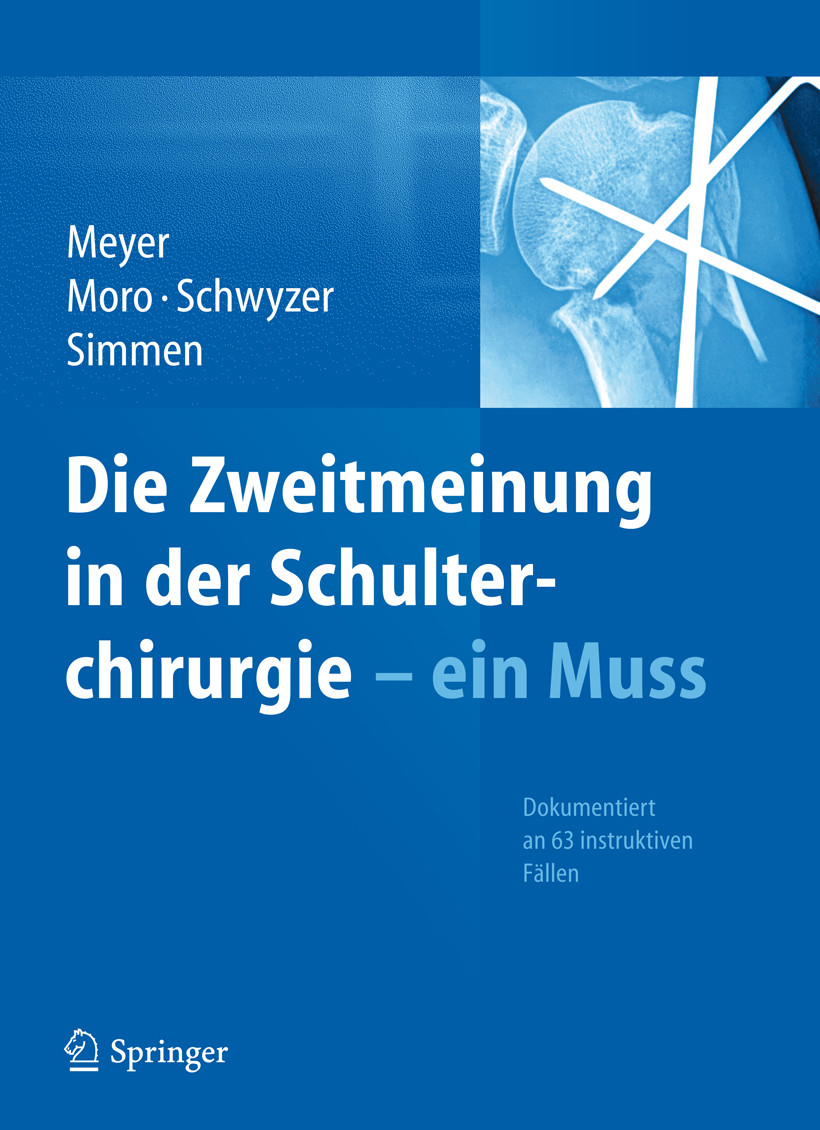 Cover Die Zweitmeinung in der Schulterchirurgie - ein Muss
