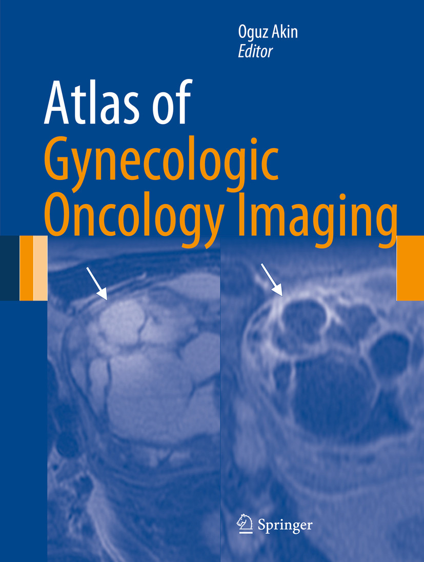 Atlas of Gynecologic Oncology Imaging