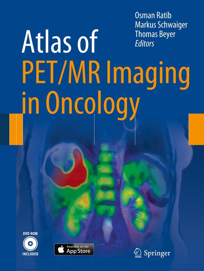 Atlas of PET/MR Imaging in Oncology