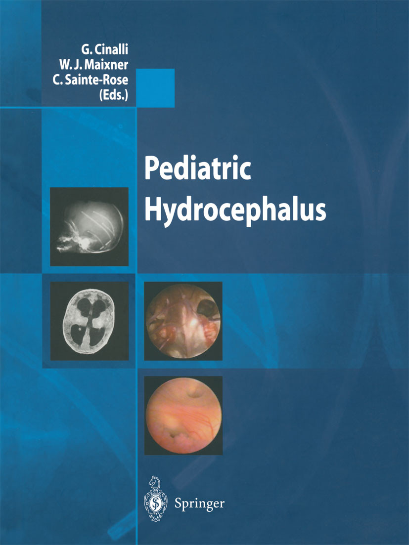 Cover Pediatric Hydrocephalus