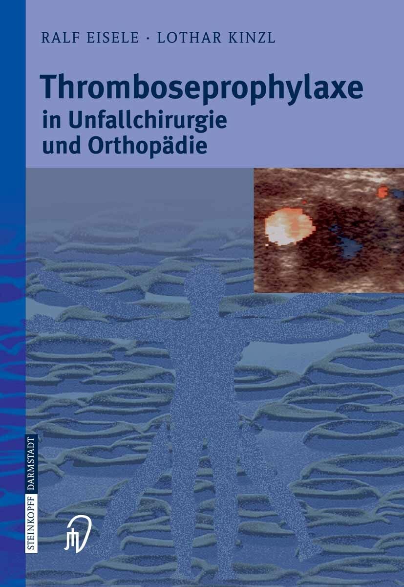 Thromboseprophylaxe in Unfallchirurgie und Orthopädie