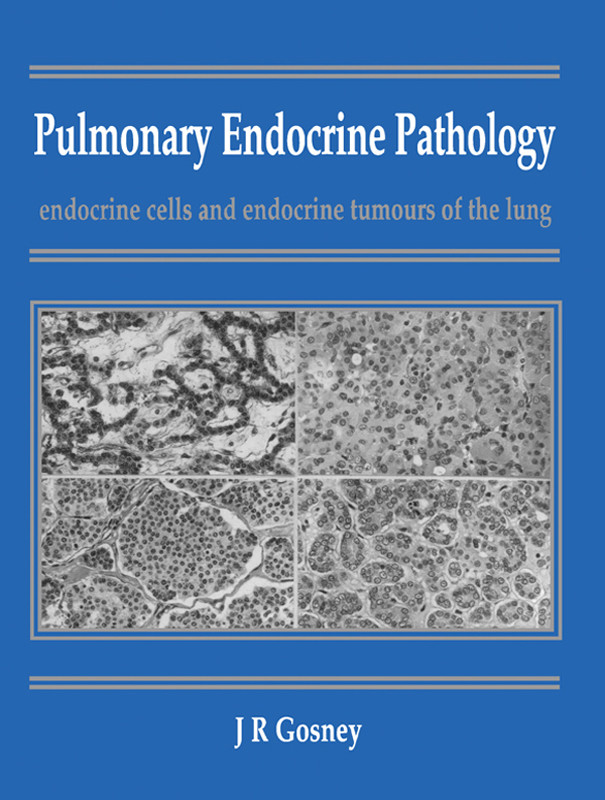 Pulmonary Endocrine Pathology