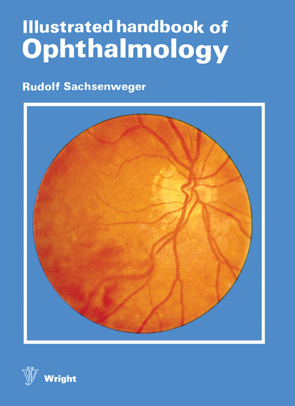 Illustrated Handbook of Ophthalmology