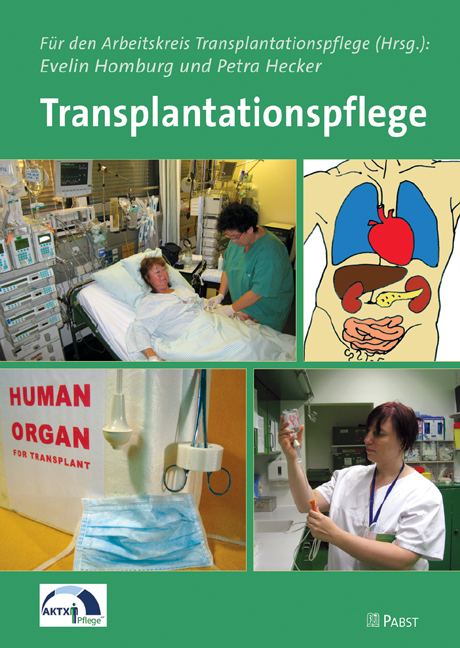 Cover Transplantationspflege
