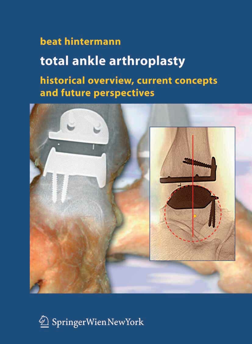 Total Ankle Arthroplasty