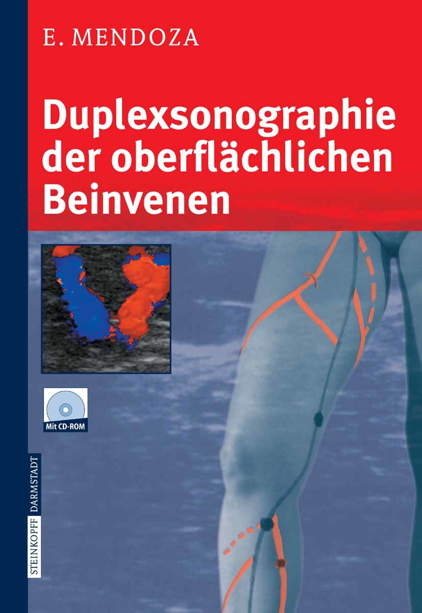 Cover Duplexsonographie der oberflächlichen Beinvenen