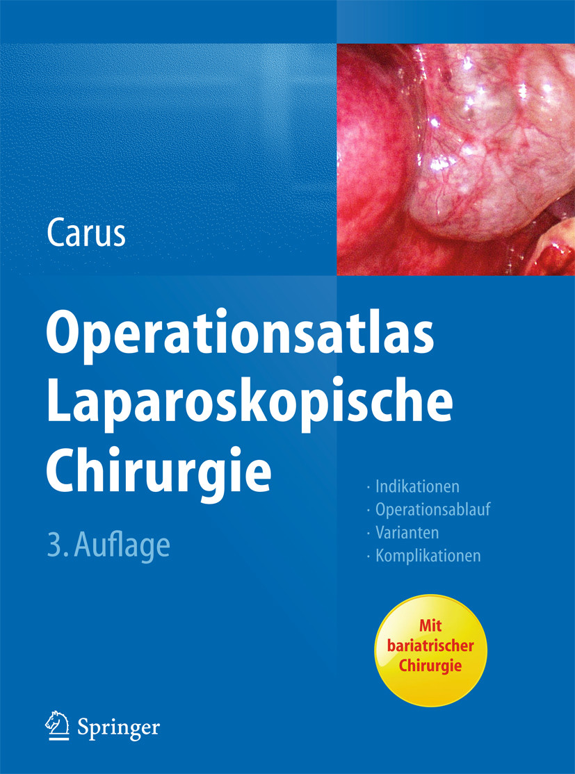 Operationsatlas Laparoskopische Chirurgie