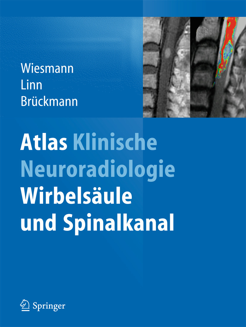 Atlas Klinische Neuroradiologie