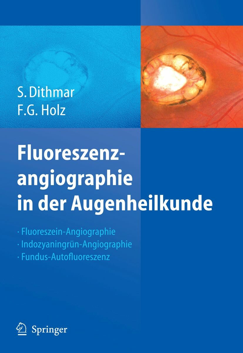 Fluoreszenzangiographie in der Augenheilkunde