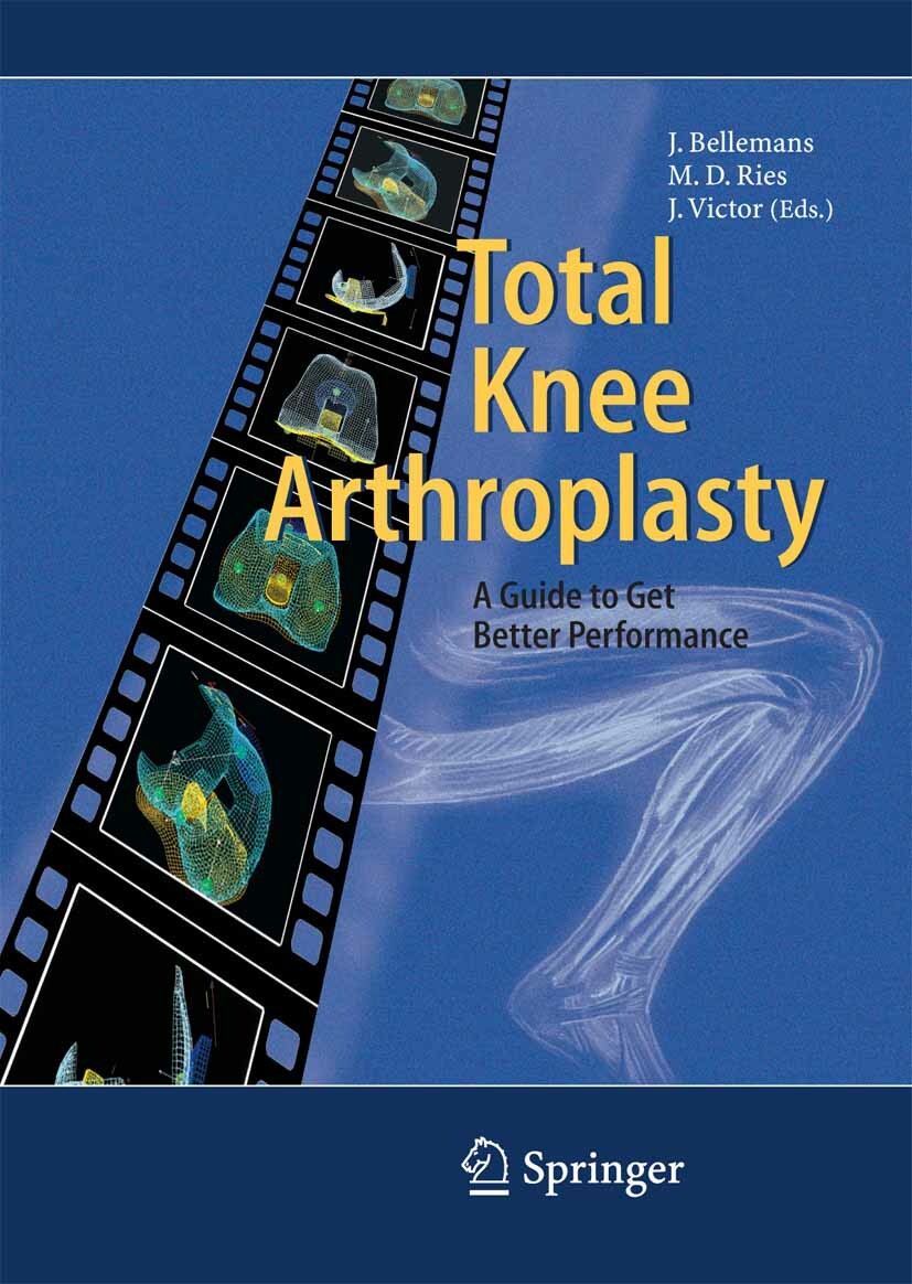 Cover Total Knee Arthroplasty