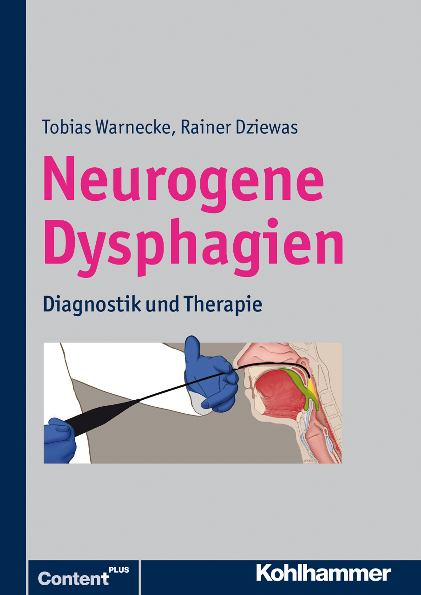 Cover Neurogene Dysphagien