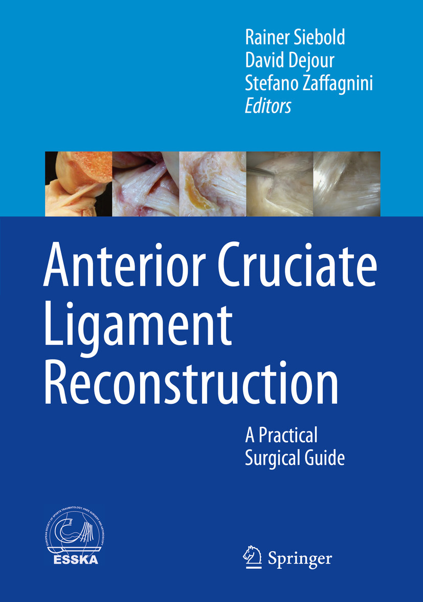 Cover Anterior Cruciate Ligament Reconstruction