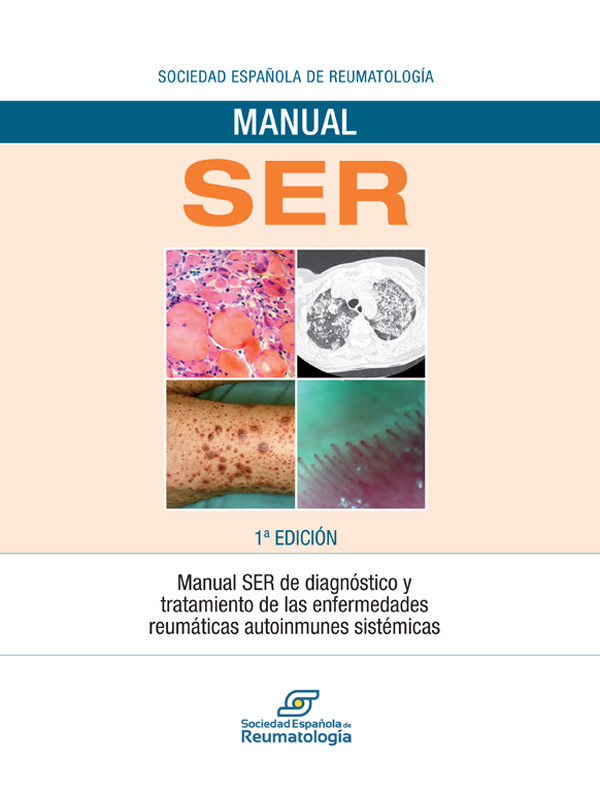 Cover Manual SER de diagnóstico y tratamiento de las enfermedades reumáticas autoinmunes sistémicas