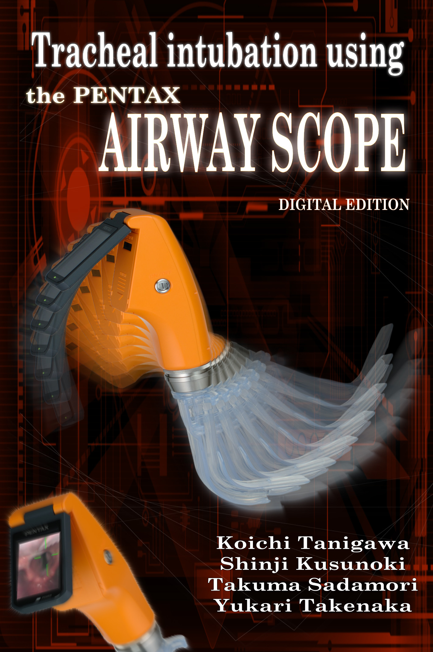Tracheal intubation using the PENTAX Airway Scope