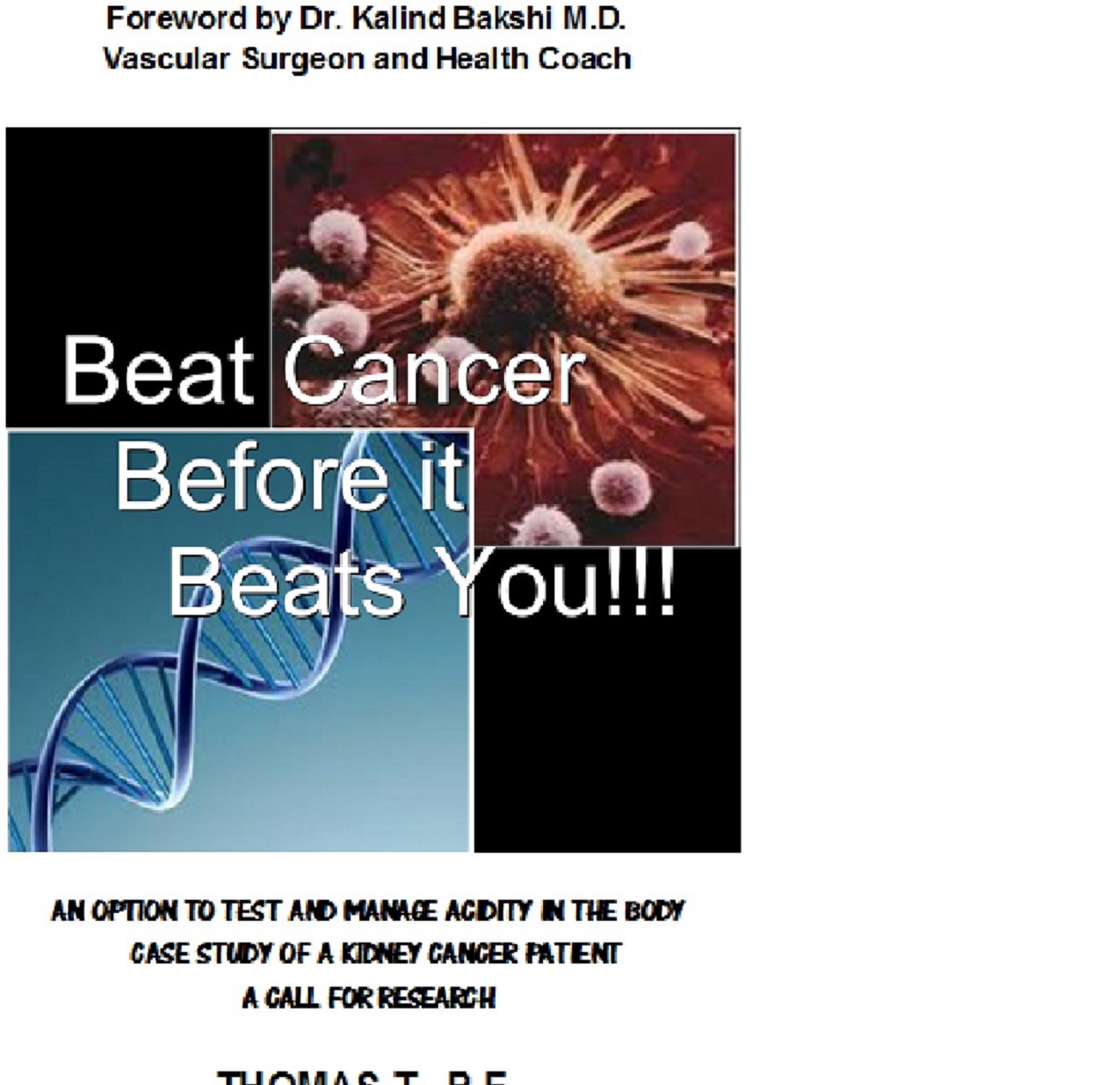 Cover Beat Cancer Before it Beats You!!!