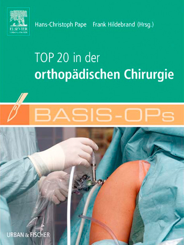 Cover Basis OPs - Top 20 in der orthopädischen Chirurgie