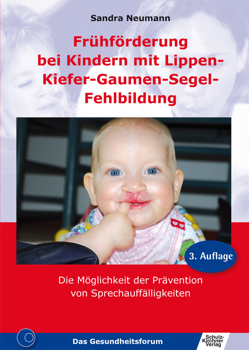 Cover Frühförderung bei Kindern mit Lippen-Kiefer-Gaumen-Segel-Fehlbildung