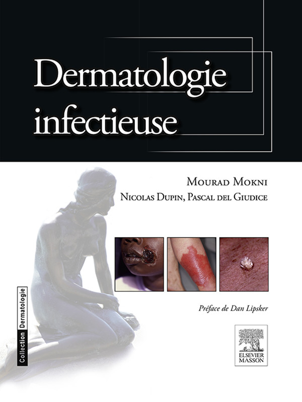 Cover Dermatologie infectieuse