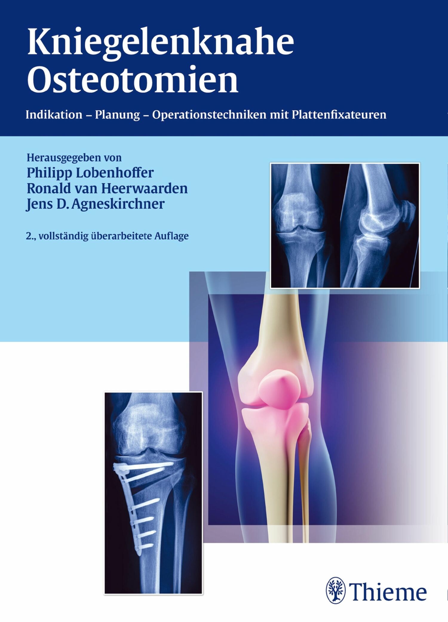 Cover Kniegelenknahe Osteotomien
