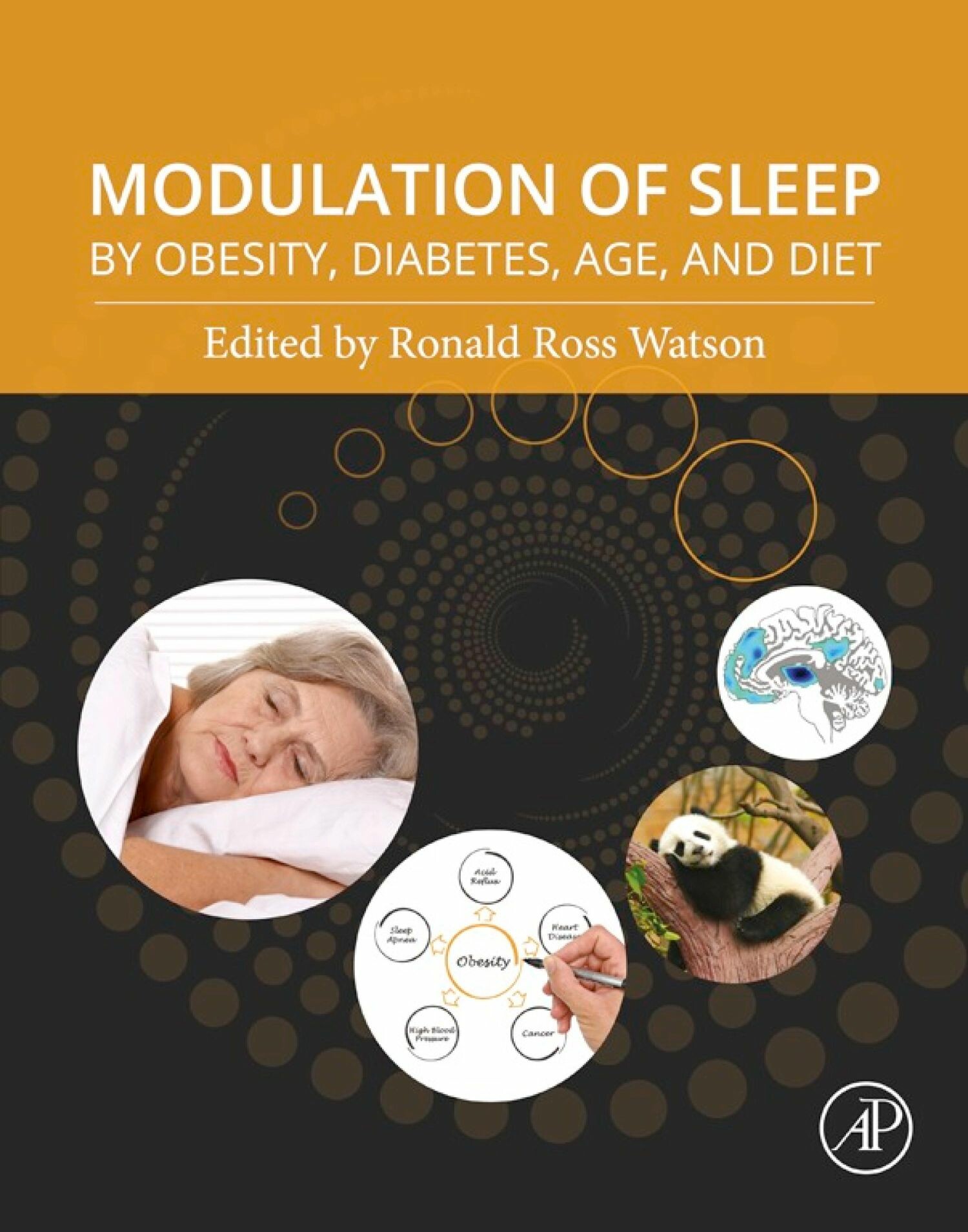 Cover Modulation of Sleep by Obesity, Diabetes, Age, and Diet