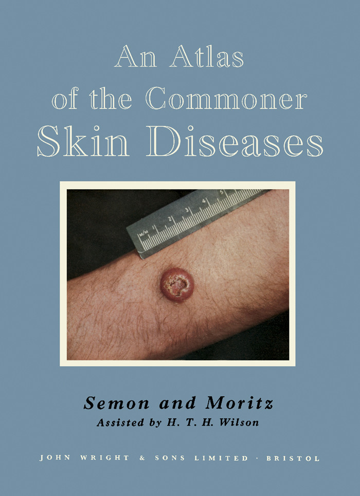 Cover An Atlas of the Commoner Skin Diseases