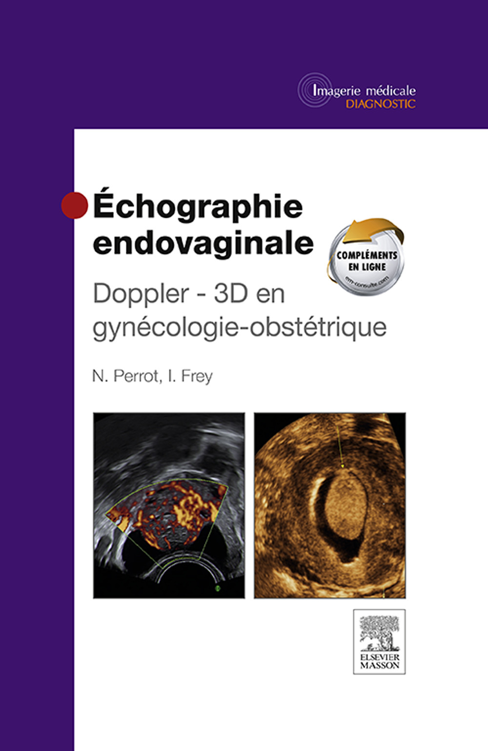 Échographie endovaginale Doppler - 3D