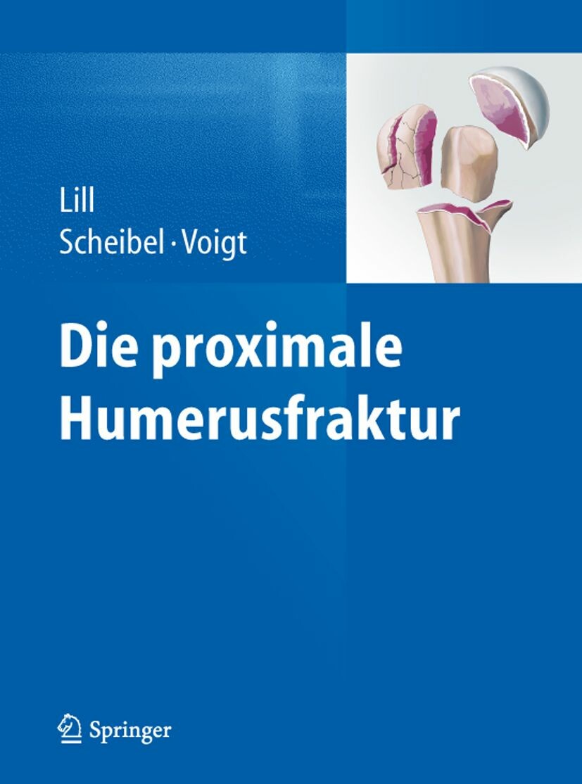 Cover Die proximale Humerusfraktur