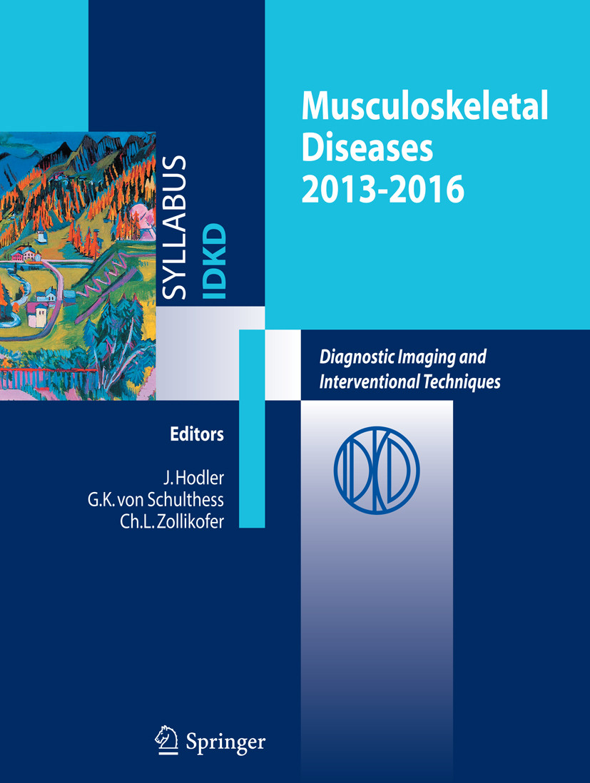 Musculoskeletal Diseases 2013-2016