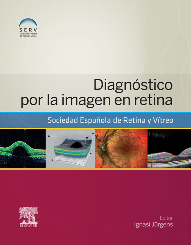 Cover Diagnóstico por la imagen en retina