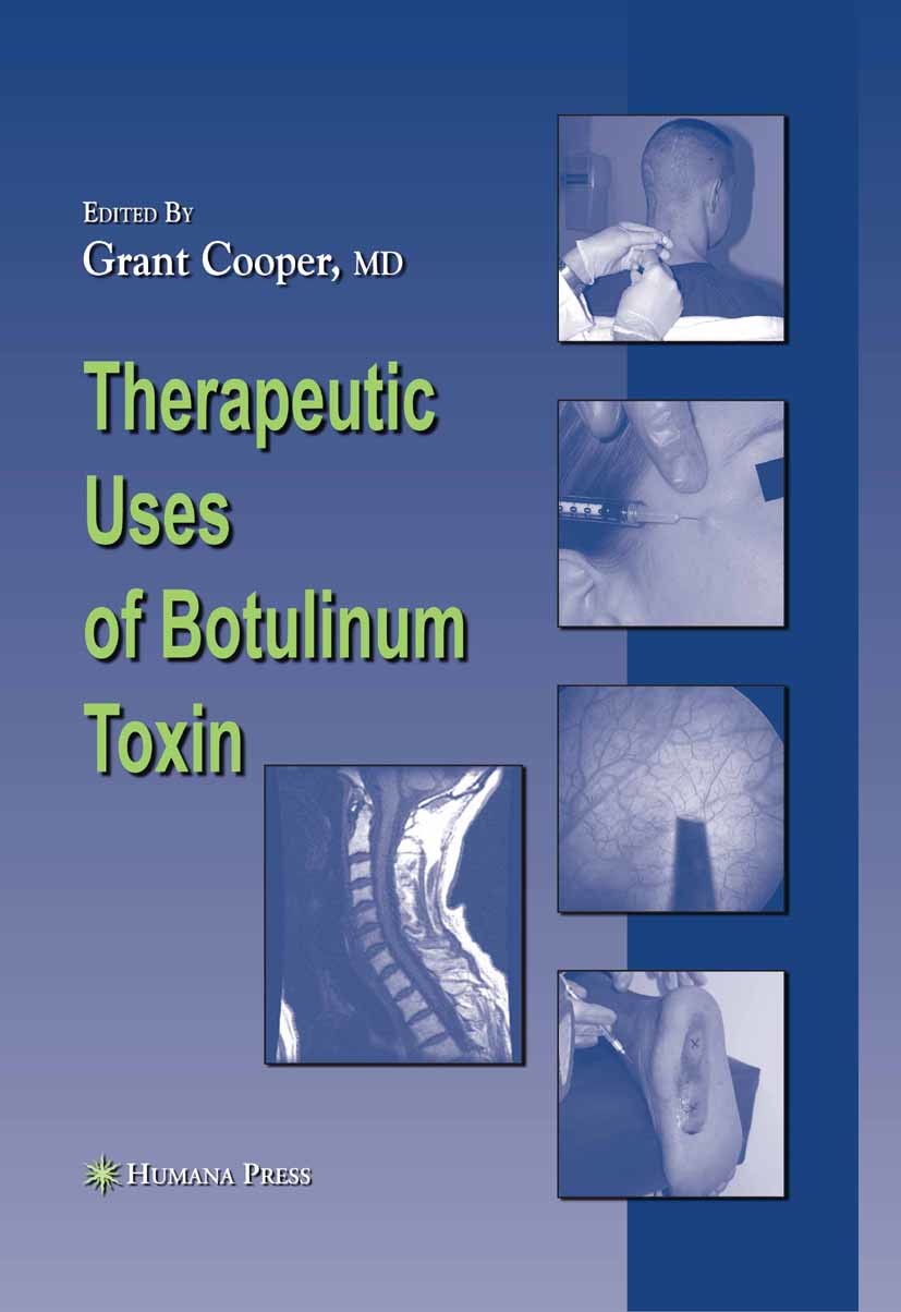 Cover Therapeutic Uses of Botulinum Toxin