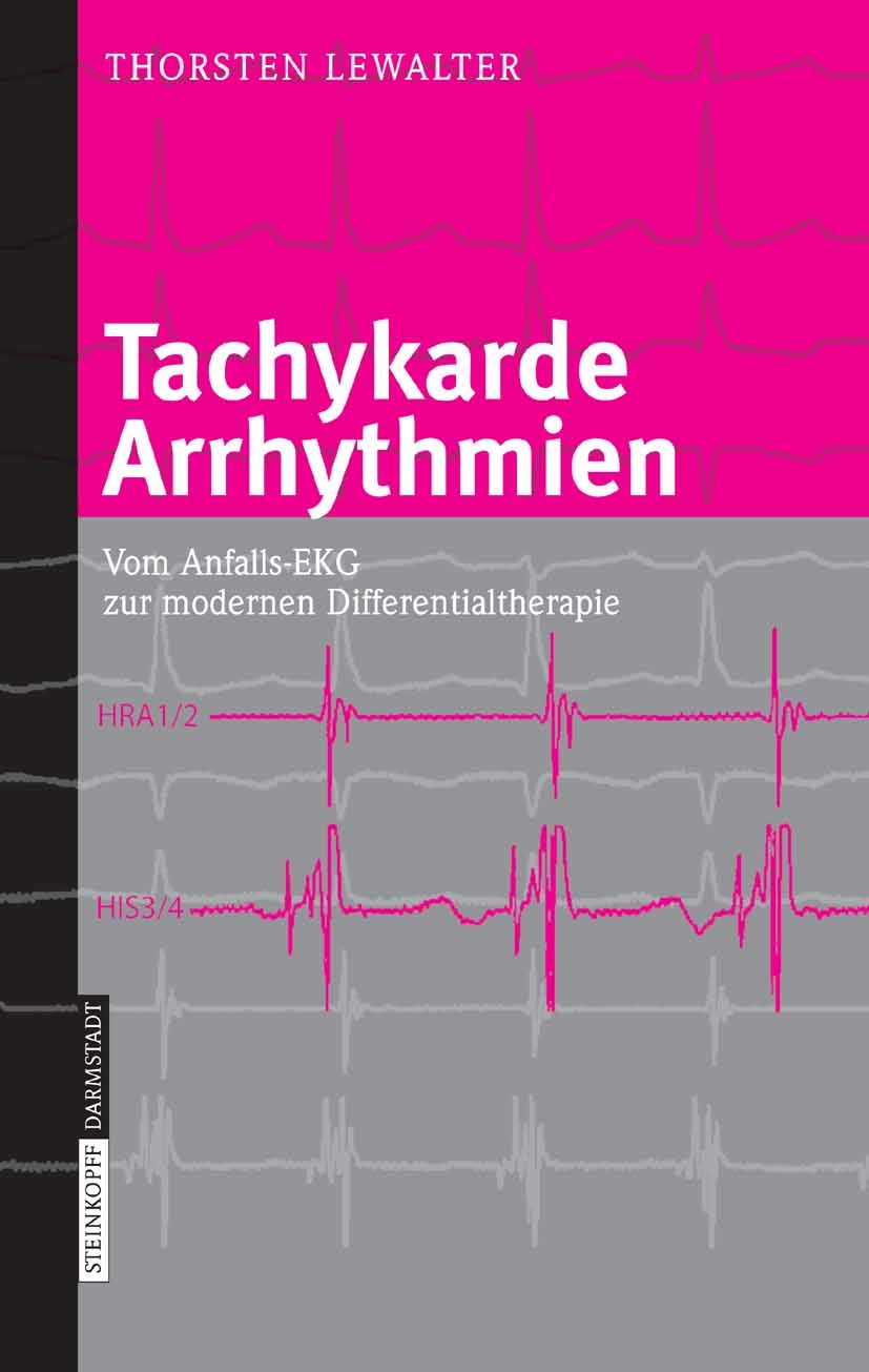 Tachykarde Arrhythmien