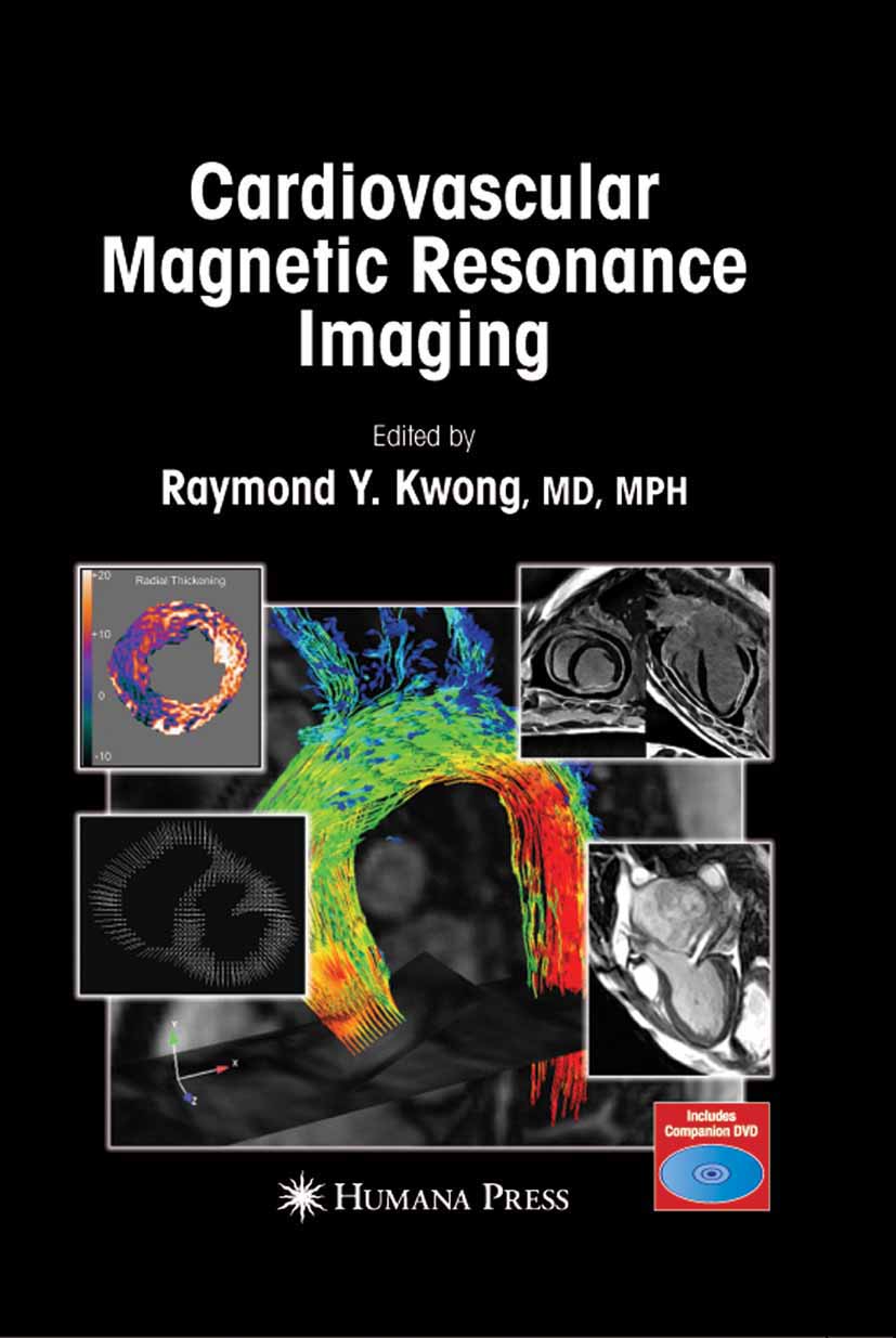 Cardiovascular Magnetic Resonance Imaging