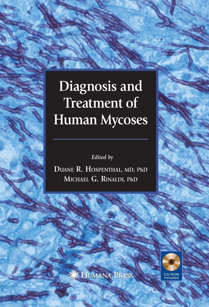 Diagnosis and Treatment of Human Mycoses