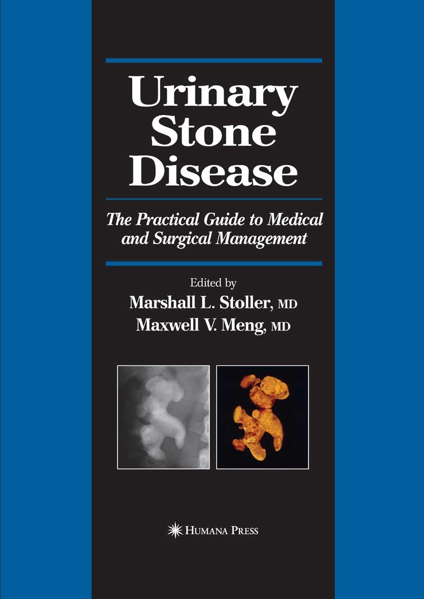 Cover Urinary Stone Disease