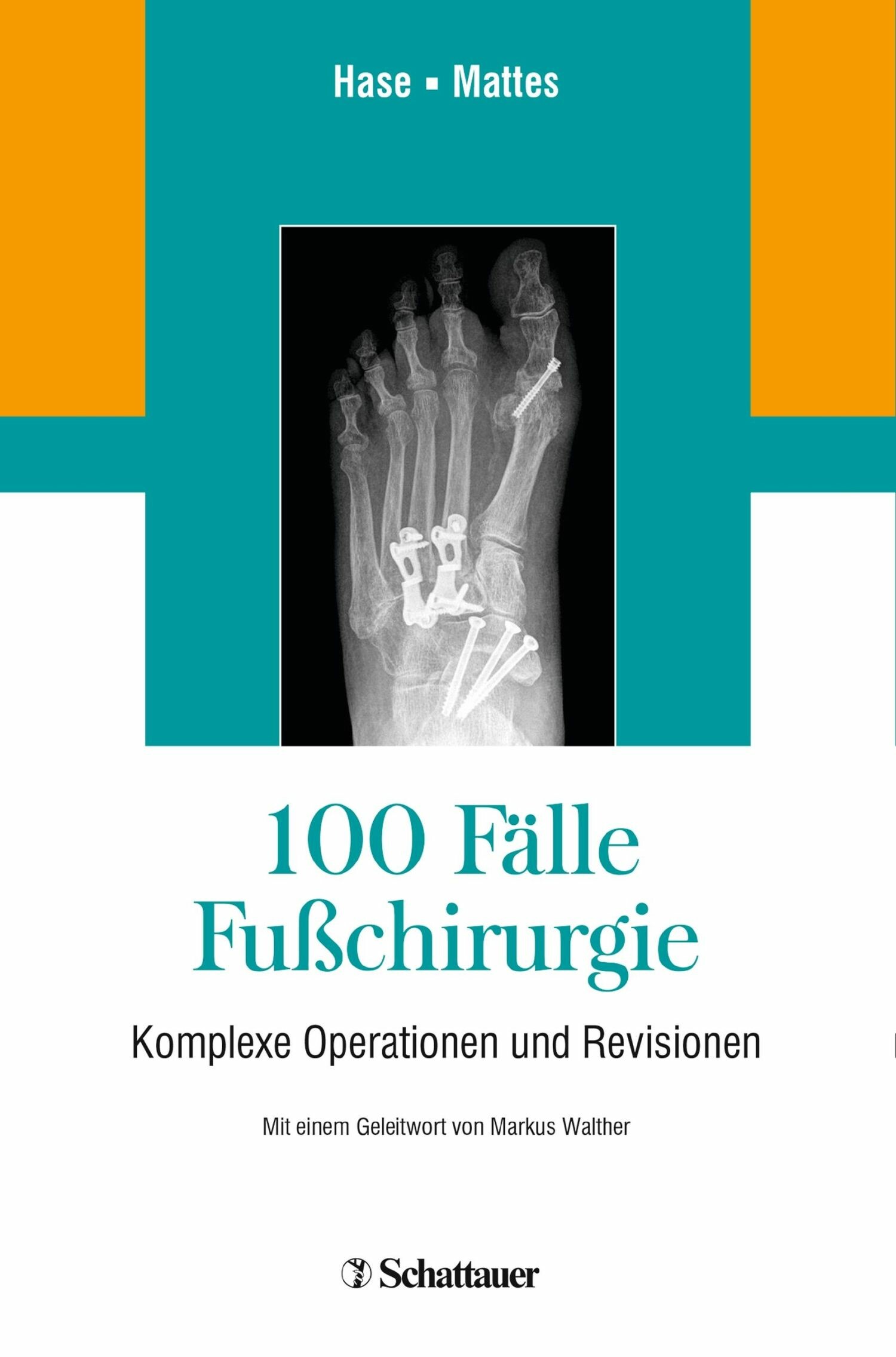100 Fälle Fußchirurgie
