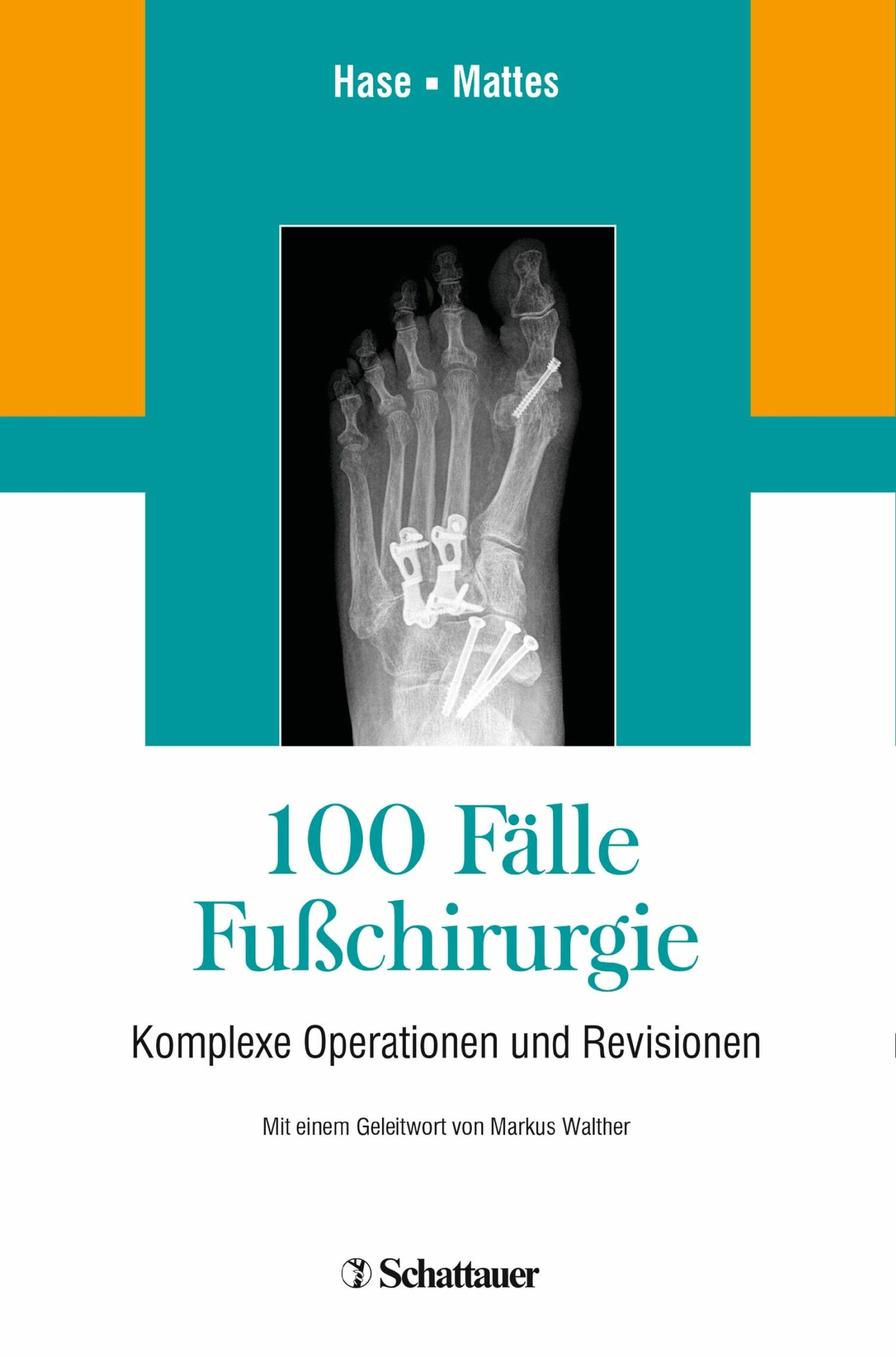 Cover 100 Fälle Fußchirurgie