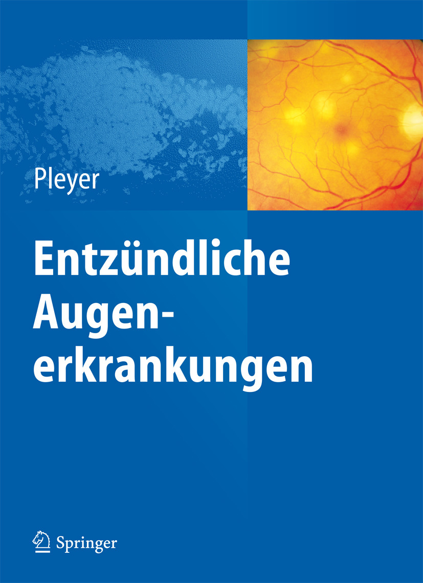 Cover Entzündliche Augenerkrankungen
