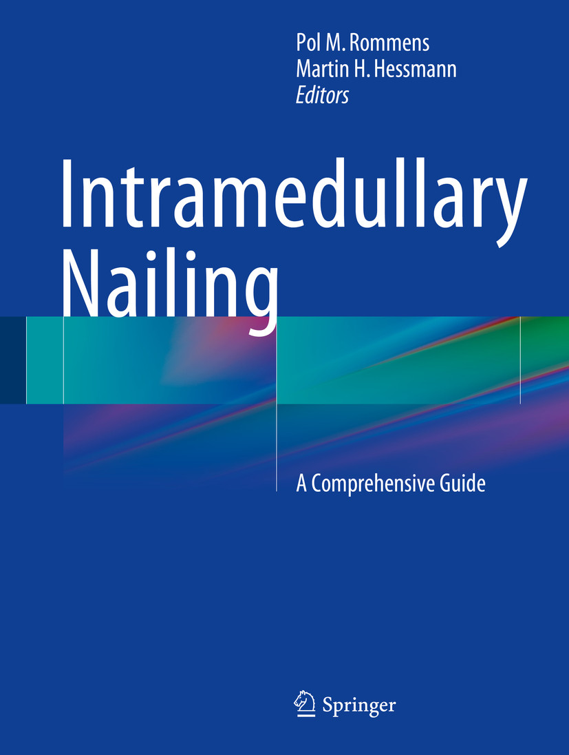 Intramedullary Nailing