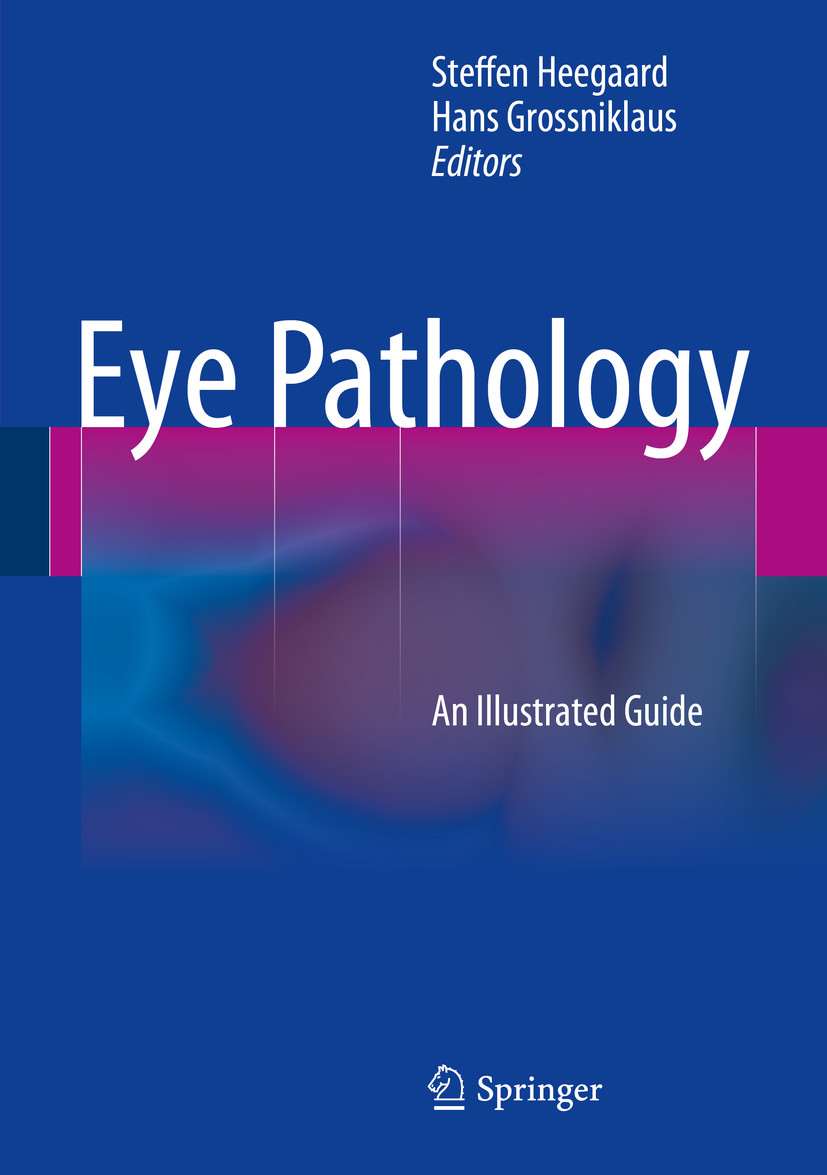 Cover Eye Pathology