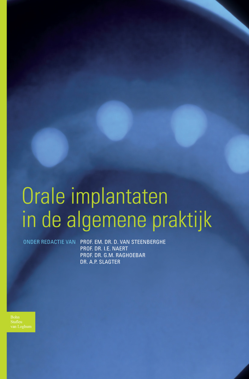 Cover Orale implantaten in de algemene praktijk